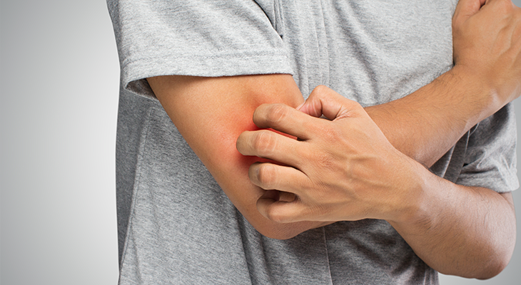 Si tienes piel sensible